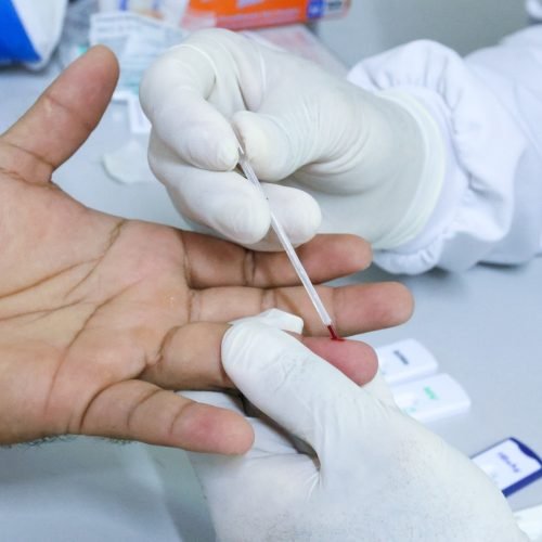 Parnamirim disponibiliza testes rápidos para sífilis, HIV e hepatites em todas as UBSs