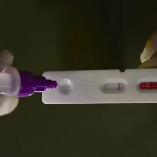 Brasil registra alta de casos de covid-19, diz levantamento