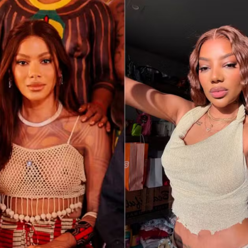 Novo rosto de Anitta revive debate sobre padrão estético entre celebridades