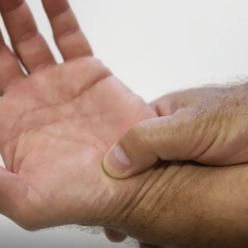 Novas diretrizes ampliam o tratamento de fibromialgia pelo SUS